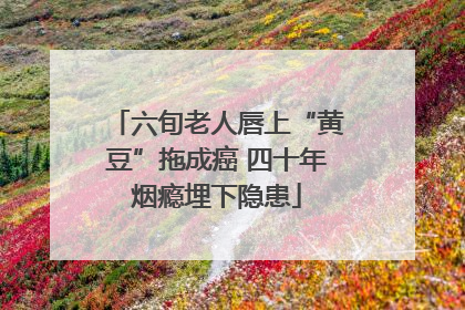 六旬老人唇上“黄豆”拖成癌 四十年烟瘾埋下隐患